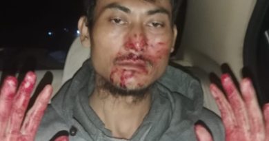 *2 Orang Pengurus FWJ Indonesia Korwil Kuningan Dikeroyok 15 Orang Ngaku Ormas Al Jabar*