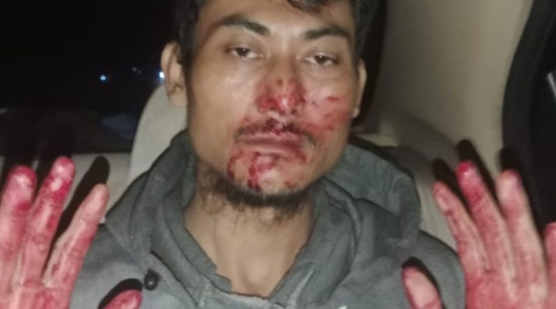 *2 Orang Pengurus FWJ Indonesia Korwil Kuningan Dikeroyok 15 Orang Ngaku Ormas Al Jabar*